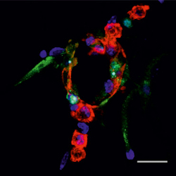 4. Cytoplasmic stress responses